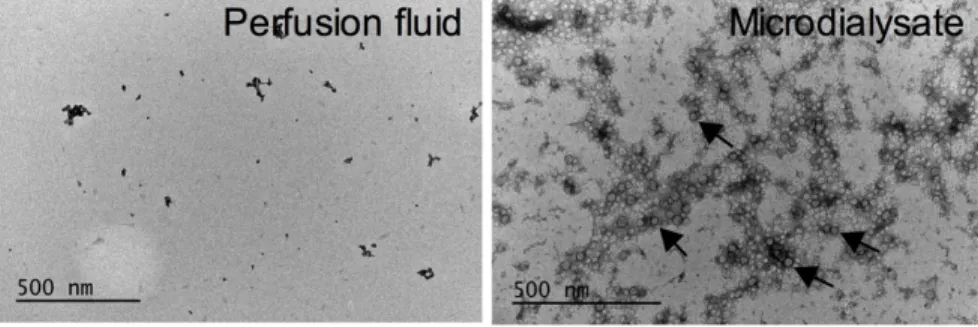 Figure 1: Microdialysis samples contain exosomes.  Electron microscope images of microdiaysis sample and control (perfusion  fluid)