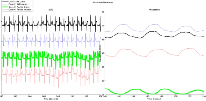 Figure 3. 10-seconds epoch of measured ECG (left) and thoracic bioimpedance (right) during controlled breathing by using metronome