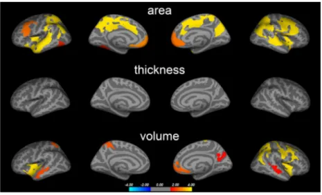 FIGURE 1  Brain abnormalities in PD (main analysis). Colored clusters represent areas in which significant differences in cortical surface area,  thickness, and volume were found between PD and HC subjects