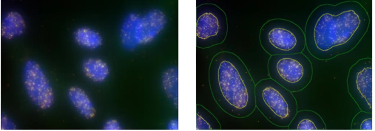 Figure 15 - The left figure shows an image in its normal state. 