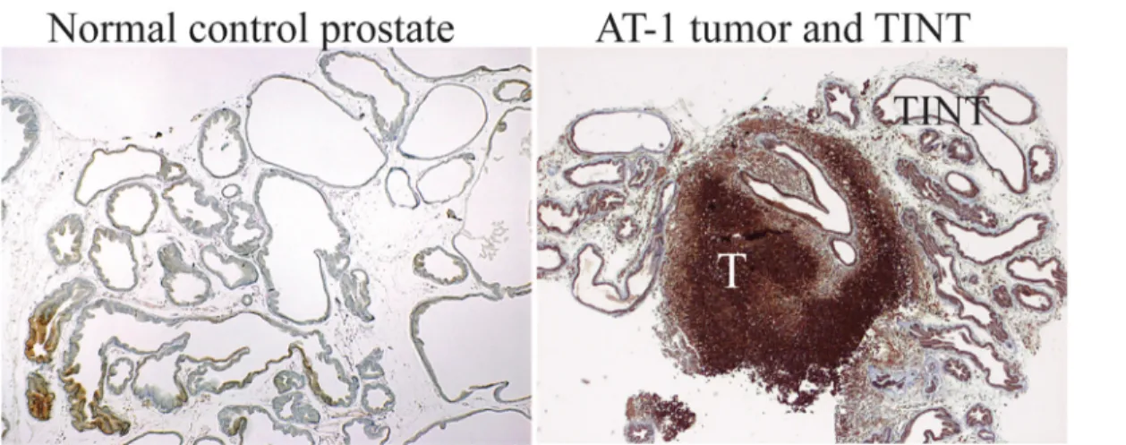 Fig 2. Hypoxic areas in tumor and TINT tissues. Pimidazole staining (brown) of hypoxic tissue areas in normal sham injected control prostate tissue, in AT-1 tumors (T), and in the tumor-adjacent normal prostate tissue (TINT) and at day 10.