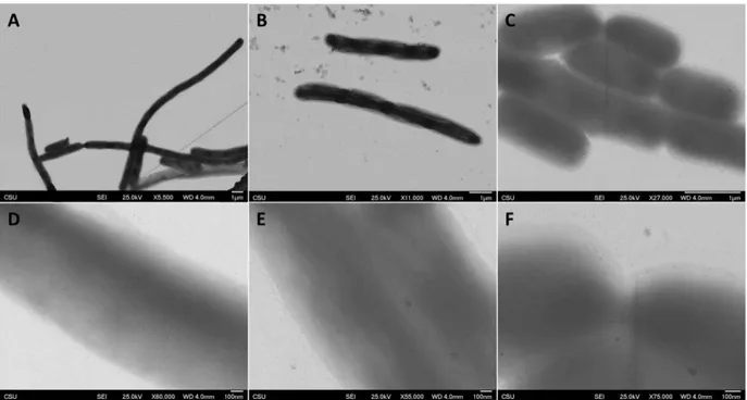 Figure 3.7: Extended expression experiment. Low magnification images of the control (A), the sample induced  with 100 µM IPTG (B), and the sample induced with 250 µM IPTG (C) are shown in the top row