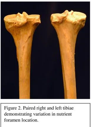 Figure 1. Paired right and left tibiae  demonstrating lack of variation in  nutrient foramen location