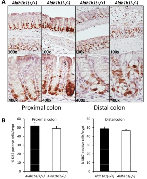 Figure 2.5. Lack of ALDH1B1 does not affect number of proliferating cells  in colon. (A) Photomicrographs of mouse colon after immunostaining with  anti-Ki-67 antibody revealed no difference in number of proliferating cells between  Aldh1b1(+/+) and Aldh1b