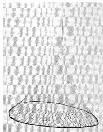 Fig.  4.  Sänkhåv  från  St.  Gullebolet,  Undenäs  socken,  invid  sjön  Unden,  Skaraborgs  län