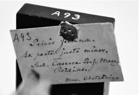 Fig. 3. The label for Ersdotter’s pelvis, with the text “A93. Pelvis femina. Ex  parte justo minor