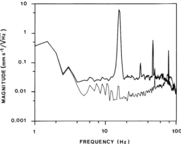 FIG. 3. Vibration velocity Spectrum: background noise - on the vibration table and in bed No
