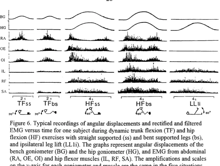 Figure 6.  Typical recordings of angular displacements and rectified and filtered  EMG versus time for one subject during dynamic trunk flex.ion  (TF) and hip  flex.ion  (HF) exercises with straight supported ( ss) and bent supported legs (bs ),  and ipsil