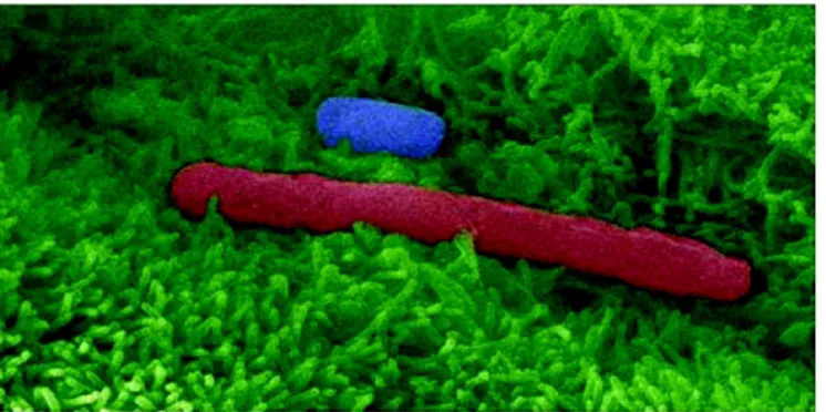 Figur 1. Bilden visar C. difficile vegetativa celler och sporer vid tarmepitelet.  C. difficile vegetativ cell (röd) lägger sig  till humana tarmepitelceller (gröna)