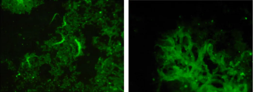 Fig. 5 Trypanosomes in the fluorescence microscopy from the antibody test. 