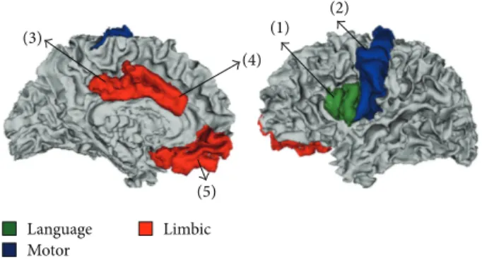 Figure 3: Anatomical locations of cortical brain areas in which significant group differences were detected for the cortical thickness, surface area, and CBF parameters; language area (green); motor area (blue); and limbic area (red)