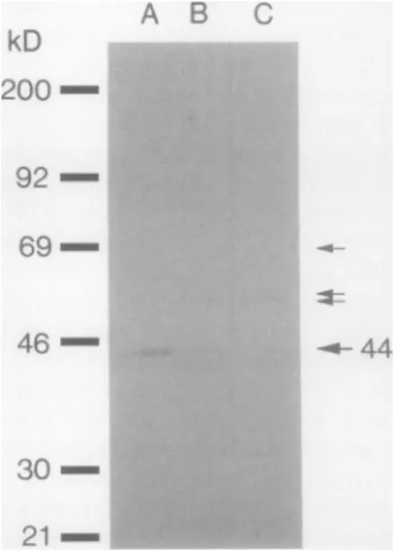 Figure 1. Western immunobloting analysis after SDS-PAGE showing the specificity of the antibodies raised against the potato tuber microsomal NADH-ferricyanide reductase