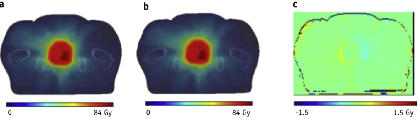 Fig. 4. Dose distribution comparison. Axial slices at the isocenter showing dose distributions from a computed tomography (CT) (a) and distorted CT (b) plan for a representative patient at a bandwidth of 244 Hz per pixel in the right to left gradient reado