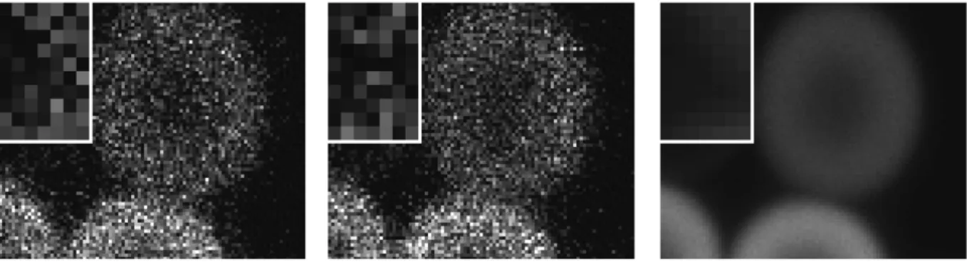 Fig.  2.  Image  Quality.  Three  images  of  the  same  specimen  (6  µm  fluorescent  microspheres)  are  shown