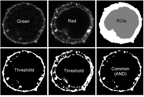 Fig.  4.  Selection  of  a  ROI  and  measurement  of  co-occurrence.  Two  channels  (Red  and  Green)  are  shown  and  each  channel  is  thresholded  to  differentiate  between  the  presence  and  absence  of  fluorescence, producing a pair of binary 