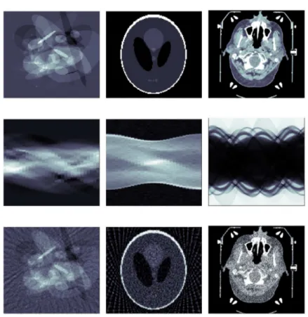Figure 1.   Examples from training data. Top row shows the phantoms, middle row the  simulated tomographic data, and the bottom row is the initial guess obtained using  FBP