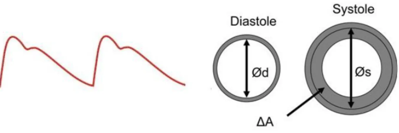 Figure 2. Aortic distension curve illustrating the diameter change from diastole to systole