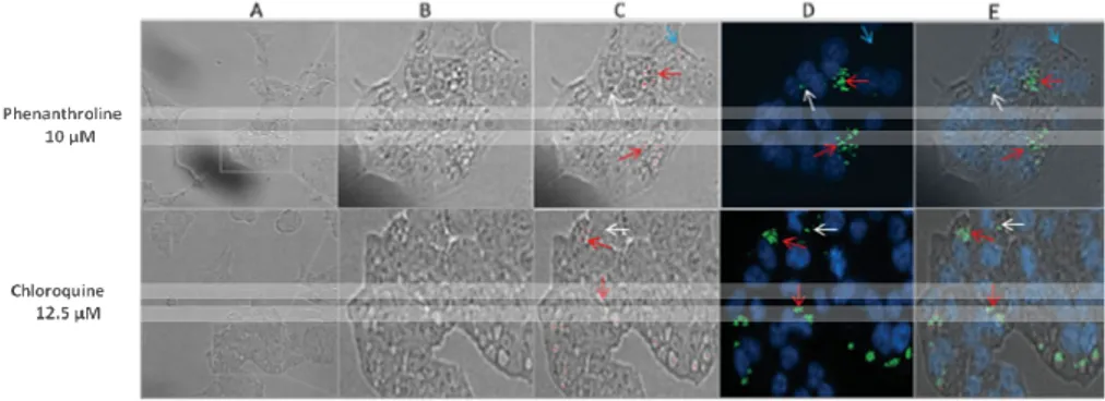 Figure 1. HCT116 cells exposed to 1,10-Phenanthroline monohydrate (10 µM) and  chloroquine (12.5 µM) for 48 hours were  labelled with Cellomics® LC3B Detection  Kits and images were acquired using the ArrayScan® HCS reader