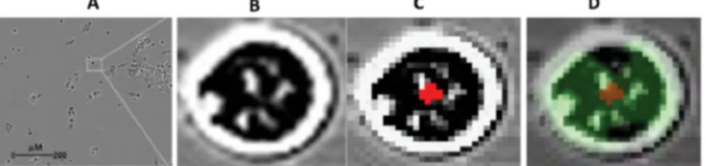 Figure 4. Detection of apoptotic cells from phase contrast images obtained from  HCT116 cells exposed to Mitomycin (10 µM) at time point 20 h