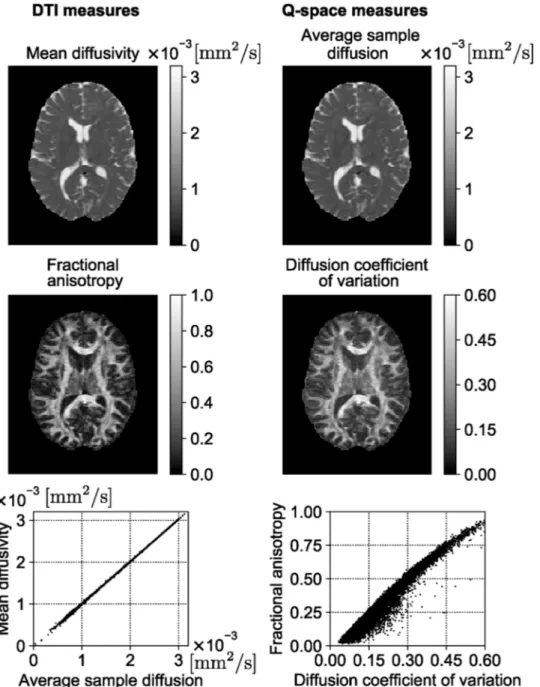 Fig. 9. Comparison of DT-MRI-based mean diffusivity to the average sample diffusion measure (ASD) and fractional anisotropy to the diffusion coefficient of  variation (CVD) all obtained from 30 diffusion-sensitizing gradient directions and b = 1000 s/mm 2 