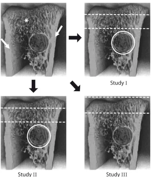 Figure 5: Image of the proximal tibia. Parts of the cortex (white arrows) have been removed to reveal  the trabecular bone underneath ( * )