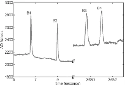 Figure 2.2: Vertical EOG (ElectroOculoGram) at the beginning and after an hour driving in a  simulator course