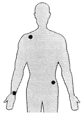 Figur 14 Elektrodplacering vid EKG-mätning. (Framifrån)