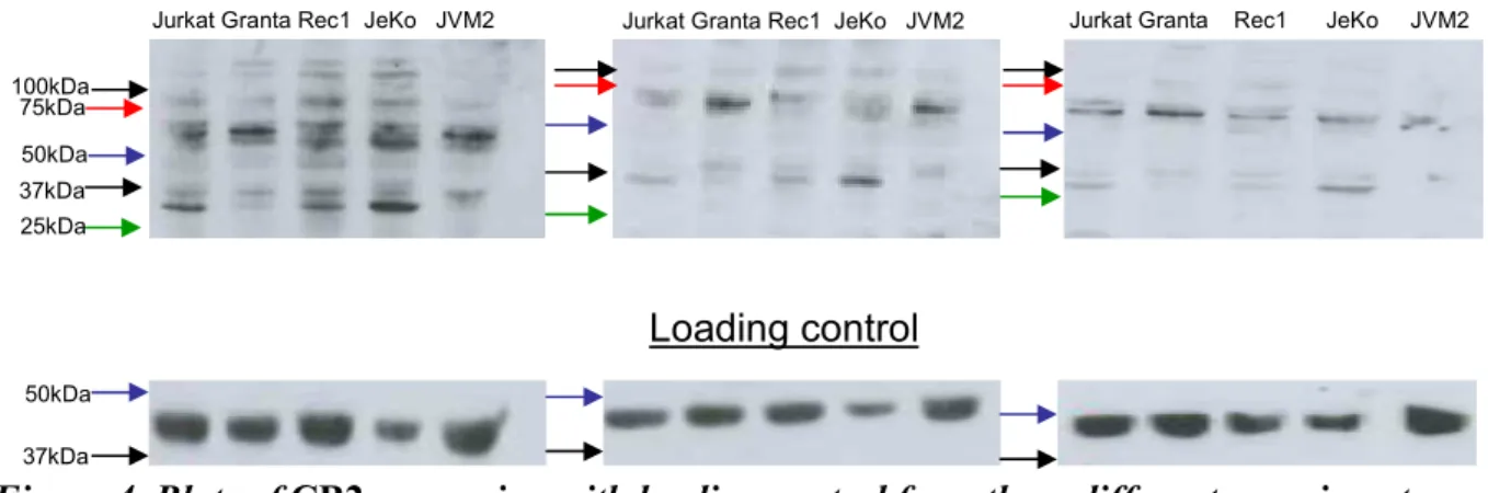 Figure 4. Blots of CB2 expression with loading control form three different experiments