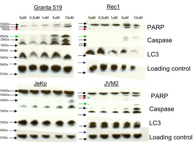 Figure 13. Control of SR1 pretreatment. Blots shows PARP cleavage only in cell treated  with 5µM and higher concentrations which proves that a concentration of 0.5µM does not  induce any programmed cell death process