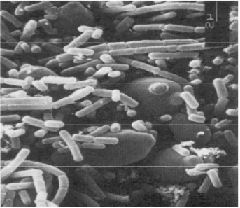 Figur B7.4. Förstoring av mikrofloran i kefir. På bilden ses de stora jästceller och små stavar  (avlånga) av laktobaciller
