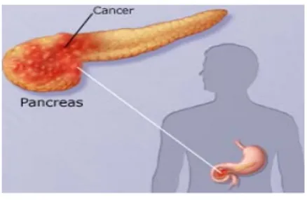 Figure 1. The location of the  pancreas [A] 