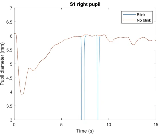 Figure 20: Shows a single PLR curve in blue, that contains two blinks between the 5-10 second interval.