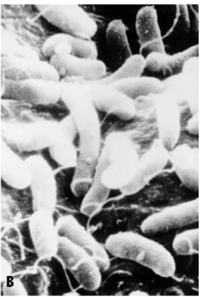 Figur 2.  Elektronmikroskåp fotografi på Vibrio Cholerae som bildat kolonier i epithelcellerna på kanin [4] 