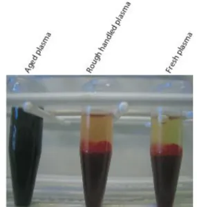 Figur 2. Frisättning från erytrocyter kan uppskattas visuellt efter centrifugering av K 2 EDTA- EDTA-helblod