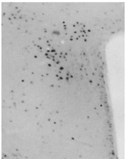 Fig. 1 Immunohistochemical staining for cFos in the PVN. 