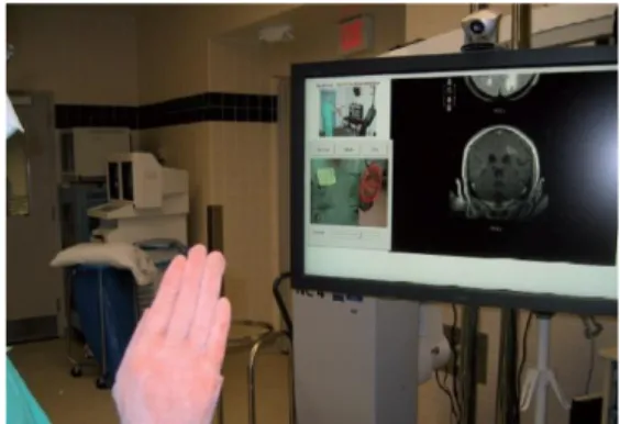 Figure 4: Using hand gestures to navigate images during a brain surgery. 