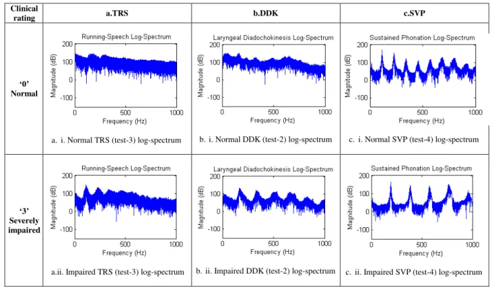 Fig. 4. A comparison between the log power spectrums of representative TRS, DDK and SVP samples, rated ‘0’ and 