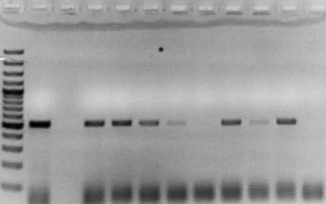 Figure 2. Picture of electrophoresis gel showing the result of the cDNA synthesis. From left to  right was the ladder, the positive control, a blank, the eight samples and the negative control