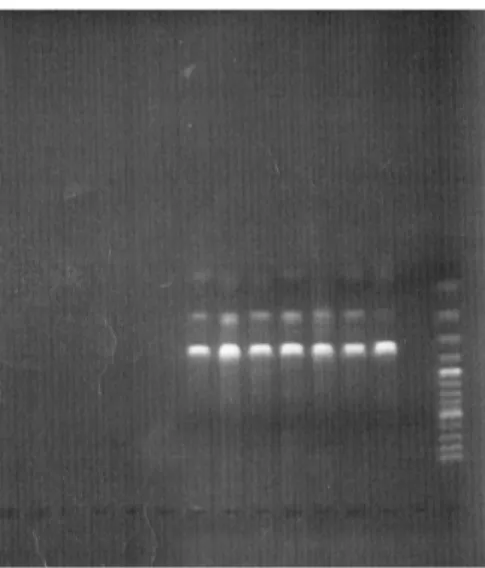 Figure 3. Quantification of Nitrobacter winogradskyi with PCR. Two dilution series were  made, with the highest concentration at the far left of the figure and declining to the right