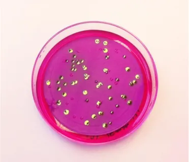 Figur 1. Koliforma bakterier karaktäriseras av koloniernas fuksinglans. Foto: Elin Agnemo 
