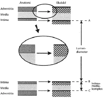 Figur 2. Kärlets anatomiska gränsskikt och motsvarande ekon i ultraljudsbilden (13).   