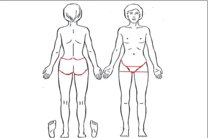 Fig. 2 Drawing of a body to indicate pain locations. Pelvic girdle pain was defined when pain was indicated within the red boarders, not shown to the women