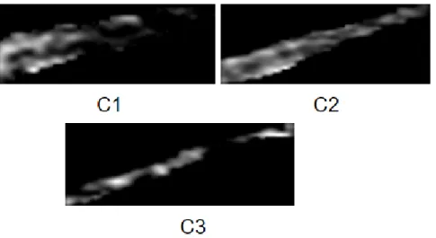Figure 7: Ultrasound images have three different class such as C1, C2 and C3. Each class represents different information