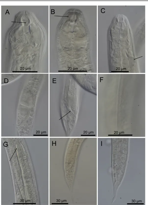 Fig. 3.  Cobbionema acrocerca Filipjev, 1922. Light micrographs. A. Female stoma showing stoma  armament, arrow pointing to the left ventrosublateral tine (SMNH-179217)