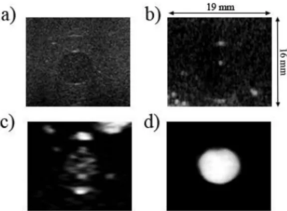 Fig.  3.  Zoomed  ultrasound  short-axis  images  of  a  vessel  phantom  containing  blood  mimic  and  polymeric  CA,  a)  conventional  gray-scale  image  (MI=0.4,  f=14  MHz),  b)  Pulse  inversion  image  (MI=0.4,  f=5/10  MHz),  c)  Power  modulation