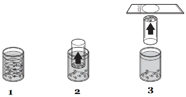 Figur 1. Preparering av objektglas i ThinPrep ®  5000 Processor. 1. Dispersion; provet blandas vilket ger upphov till  strömmar,  vilka  avskiljer  oönskat  material  samt  sönderdelar  slem  och  blod  utan  att  påverka  morfologin  hos  cellerna