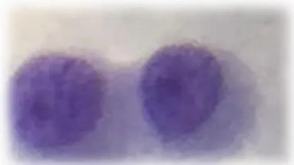 Figur  1:  Mesotelceller.  Mononukleära,  runda celler med rund kärna. Fotografiet  är  taget  i  ljusmikroskop  genom  40x  objektiv.