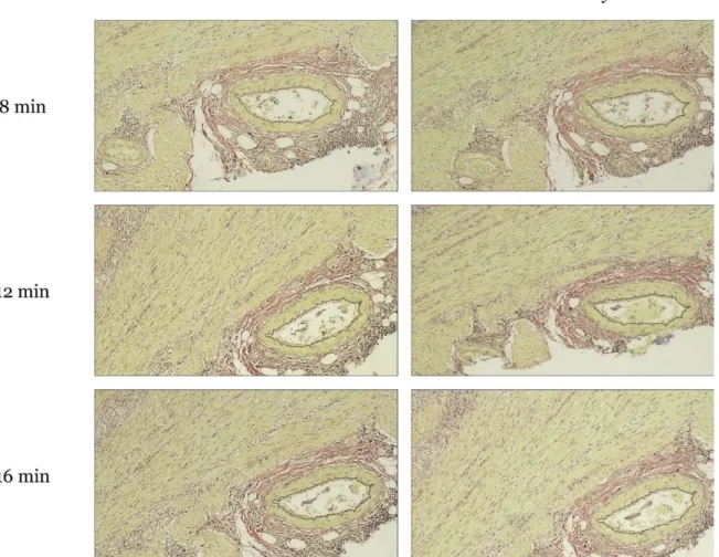 I syfte att  optimera elastininfärgning enligt  Hart färgades colon med kärl (n=6; figur 3), njurvävnad  (n=6;  figur  4),  hudvävnad  (n=6;  figur  5)  samt  navelsträng  (n=6;  figur  6)  i  8,  12  respektive  16  min