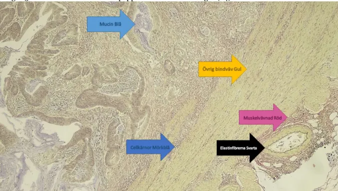 Figur  3.  Färgerna  på  resultatet  vid  automatisk  infärgning  enligt  Hart.  Elastinfibrerna  blev  svarta,  kärnorna  mörkblå, muskelvävnaden röd, övrig bindväv gult samt mucinet blått