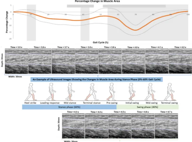 Figure 5. Percentage changes in muscle area in a gait cycle measured by the newly developed mobile  SMG system of ten healthy subjects